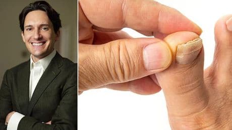 This is EXACTLY how to fix your crusty, yellow and thickened toenails - and how to tell if they're a sign of something more sinister, by Harley Street podiatrist STEVEN THOMAS