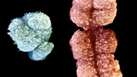 A Genetic Clue to Why Men Are Taller Than Women