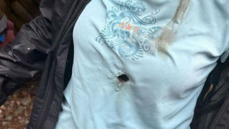 Blitz trifft deutsche Touristin mitten in den Brustbereich