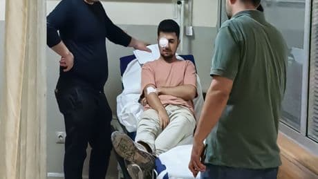 Bursa'da dehşet! İşçinin gözüne çivi saplandı