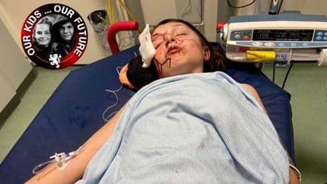 "She got away with it" Mum of autistic girl battered in park shares harrowing hospital pic as attacker walks free