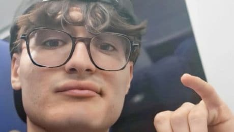 Federico Moschetti, accompagna un'amica in monopattino e viene investito: morto a 17 anni dopo 5 giorni in coma. L'ultimo gesto d'amore dei genitori