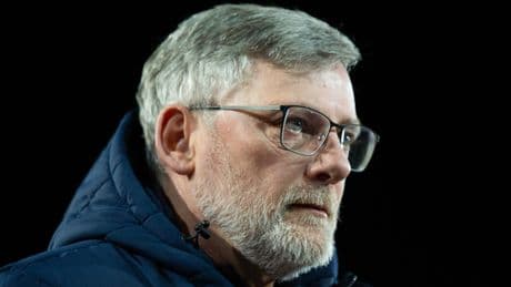 Ex-Hearts & Scotland boss Craig Levein reveals triple heart bypass surgery