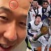 Tottenham captain Son Heung-min left with battle scar following freak injury during Europa League final celebrations