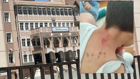 Urfa'da bir öğretmen 10 yaşındaki öğrencisini darbetti