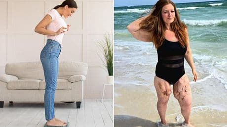 Can you REALLY lose weight on Mounjaro and avoid loose skin? We asked the experts - and their responses will horrify you