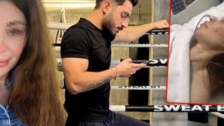 İş görüşmesine giderken dehşeti yaşadı! Boks hacasından bıçaklı yumruklu saldırı