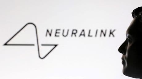 Musks Gehirnchip-Firma Neuralink sammelt 650 Millionen Dollar ein