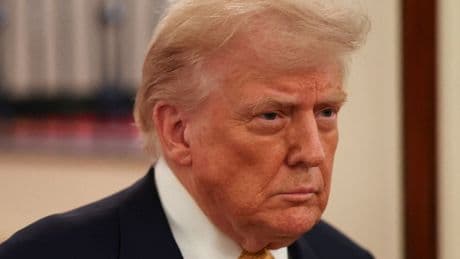 Casa Bianca, Trump ha insufficienza venosa cronica