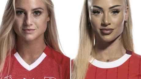 Hätten Sie sie erkannt? - Beauty-Doc erklärt Alisha Lehmanns krasse Verwandlung