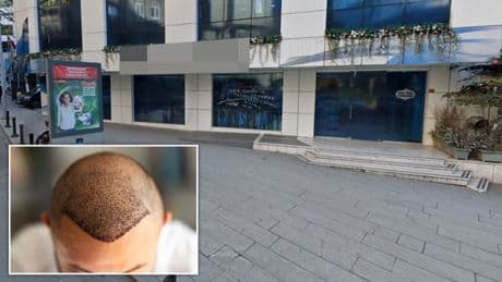 British tourist, 38, dies after Turkey hair transplant goes wrong
