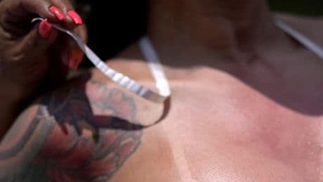 "Sun-tattoo", "burn-lines" ou "tan-lines": le ministre de la Santé alerte sur des tendances dangereuses d'exposition au soleil