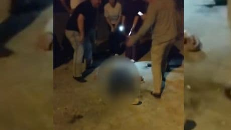 Ankara’da kadına şiddet: Balkondan atladığı iddia edilen kadın ağır yaralandı