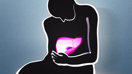 A Cancer-Causing Virus Hiding in Millions of Americans