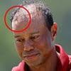 Plastic surgeon reveals the rumored surgery Tiger Woods had that has failed TWICE