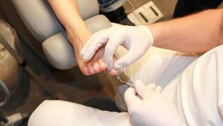 Sólo cinco CCAA incorporan podólogos a sus servicios de Atención Primaria pese a que Sanidad exige integrarlos