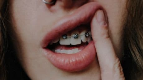 Ortodoncia de película: un árbitro y un taxista, condenados por quitar unos aparatos con indicaciones telefónicas de un dentista