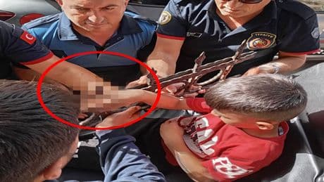 Dut yemek isteyen 8 yaşındaki çocuğun eli korkuluk demirine saplandı