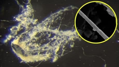 Elektriği taşıyabilen bakteri keşfedildi