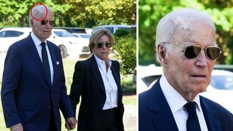 Biden spotted with giant bandage on head after having surgery to treat skin cancer
