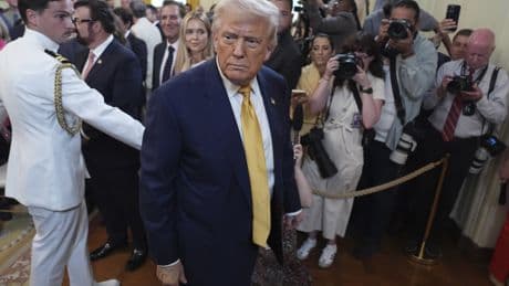 Trump diagnosed with chronic venous insufficiency, White House says