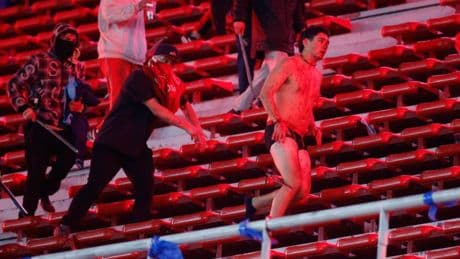 Diez heridos y 90 detenidos tras disturbios en un partido de fútbol entre el Independiente y la Universidad de Chile en Argentina