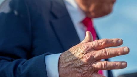Donald Trump souffre d’insuffisance veineuse, après avoir fait état de jambes enflées