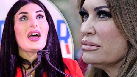 Dikke lippen, witte tanden en spraytan: Mar-a-Lago-gezicht is een fenomeen in VS