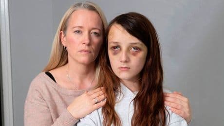 Mum shares image of child 'black and blue' after being knocked unconcious in random attack