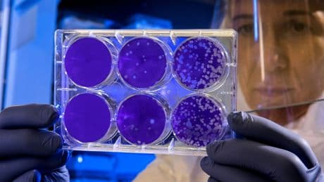 Un nouveau médicament révolutionnaire pourrait empêcher vos cellules de s'autodétruire et mettre un terme au vieillissement