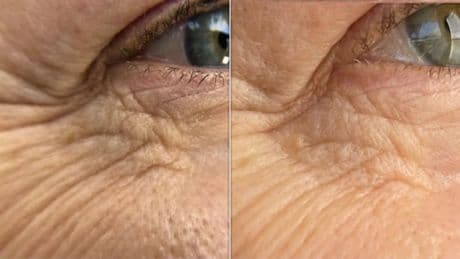 This Is The Anti-Ageing Tool Celebrities Actually Keep In Their Beauty Kit