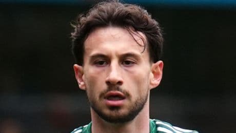 Kuhn Celtic training injury clarified as winger spotted with stitches