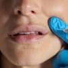 AI tool put to test sifting public views on botox and fillers