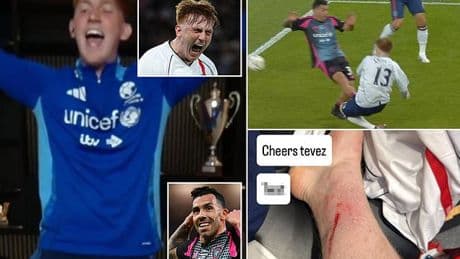 Soccer Aid star Angry Ginge mocks Carlos Tevez with hilarious chant - after labelling former footballer a 't***' for horror tackle which gashed his leg