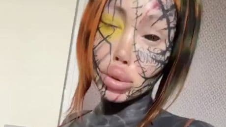 Surgery-addicted model left with eye glued shut as tattoo goes horribly wrong
