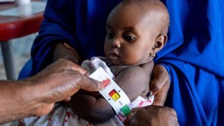 Nigeria : plus de 600 enfants morts de malnutrition ces six derniers mois, alerte Médecins sans frontières