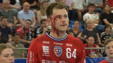Plötzlich fließt das Blut - Schocker-Szene im Handball-Abstiegskampf