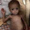 “Alsof ze nooit vrede zal kennen”: het verhaal achter baby Siwar, symbool van de honger in Gaza