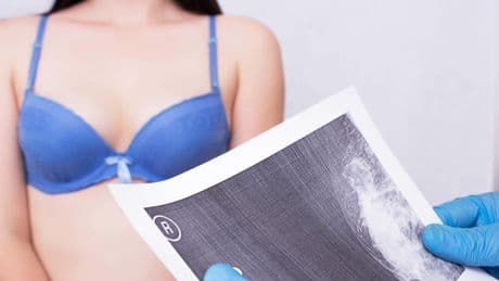 Thousands of cancer cases could be prevented with more breast removal surgeries