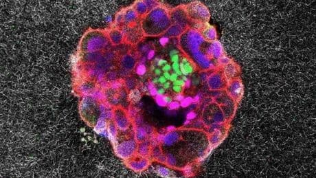 Dramatic Footage Captures Human Embryo Implanting In Real Time