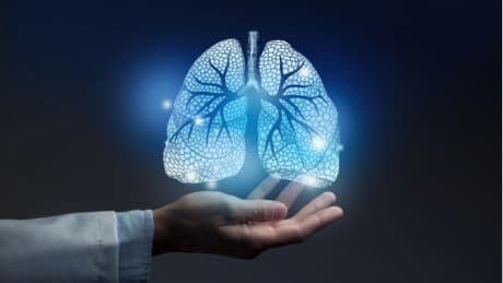 Tumori, Fondazione Fonicap: "Lung unit per tutti i pazienti con cancro polmone"