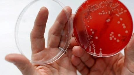 Una investigación alerta del descenso del PIB Por efecto de las superbacterias