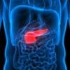 Major pancreatic cancer breakthrough as experts pinpoint common habit that triggers the deadly disease