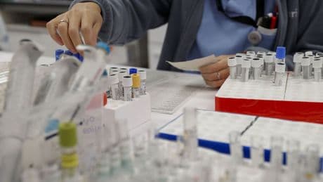 Las nuevas "terapias inteligentes" contra el cáncer: atacan células y frenan el crecimiento del tumor de ovario