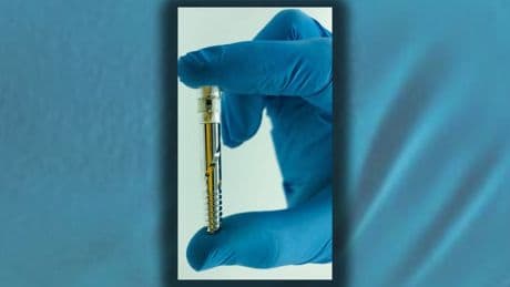 Micro sensori che trasmettono dati da dentro il corpo: ecco come le protesi smart rivoluzionano la medicina