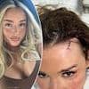 Woman punched 'for being an influencer' while taking selfies on a night out reveals 'sick' messages she receives from men telling her she 'deserved it'