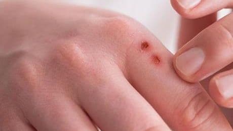 Basit görünüyor ama derin sorunların habercisi! İyileşmesi için doğru yaklaşım şart