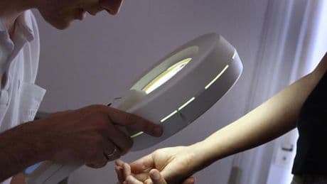 Gesundheit: Männer haben häufiger Hautkrebs als Frauen