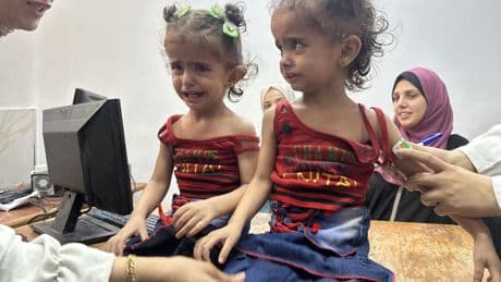 El hambre infinita de Gaza: más desnutridos en seis meses que en los dos años anteriores