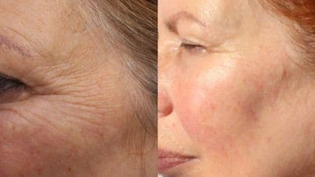 Shoppers 'obsessed' with £13 retinol serum that 'smooths deep wrinkles' in two months
